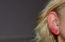 Allergie Piercing: Ein neuer Ansatz zur Linderung von Allergiesymptomen (Foto: AdobeStock - 818930423 Claudia Evans)